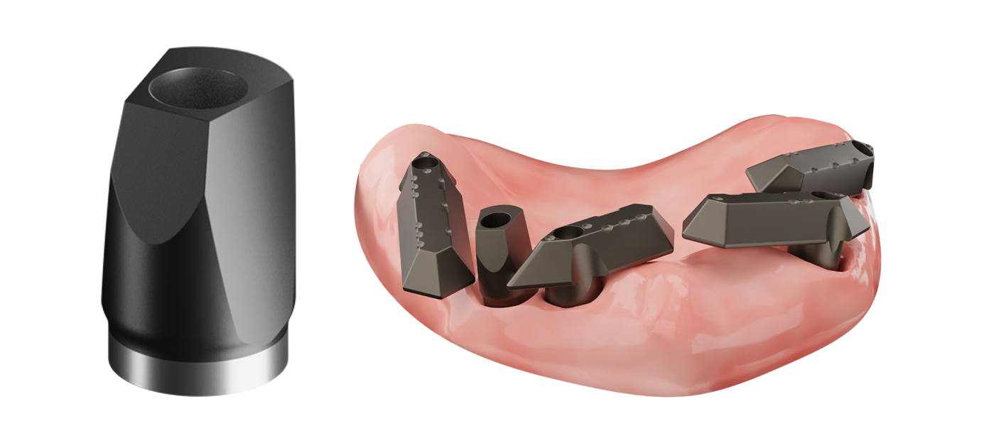 nexus-gen-2-narrow-scan-body.png
