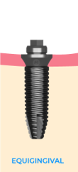 Equigingival-MUA-selection.png